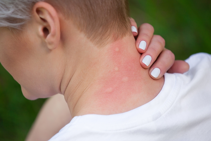 La guerra contra los mosquitos también se libra en los portales de segunda mano